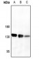 Anti-CD13 Antibody